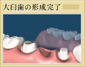 3本分のブリッジを作製