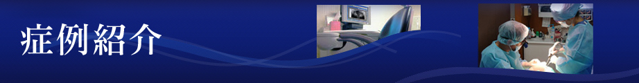 症例紹介